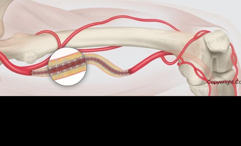 Stent Cook