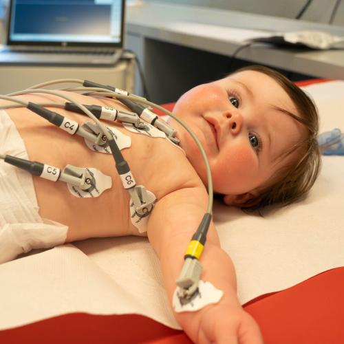 EKG