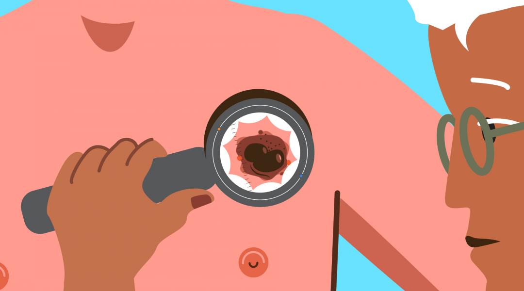 diagnose kwaadaardig vlekje