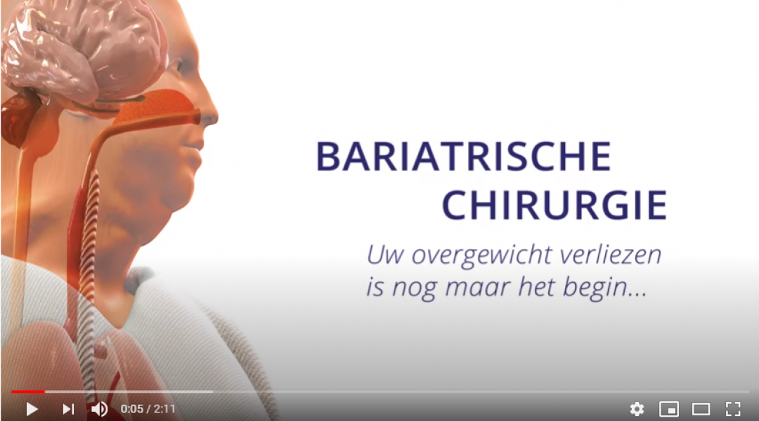 positieve gevolgen chirurgie vrouwen